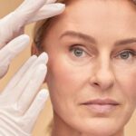 Facelift: Beneficios, Procedimiento y Recuperación